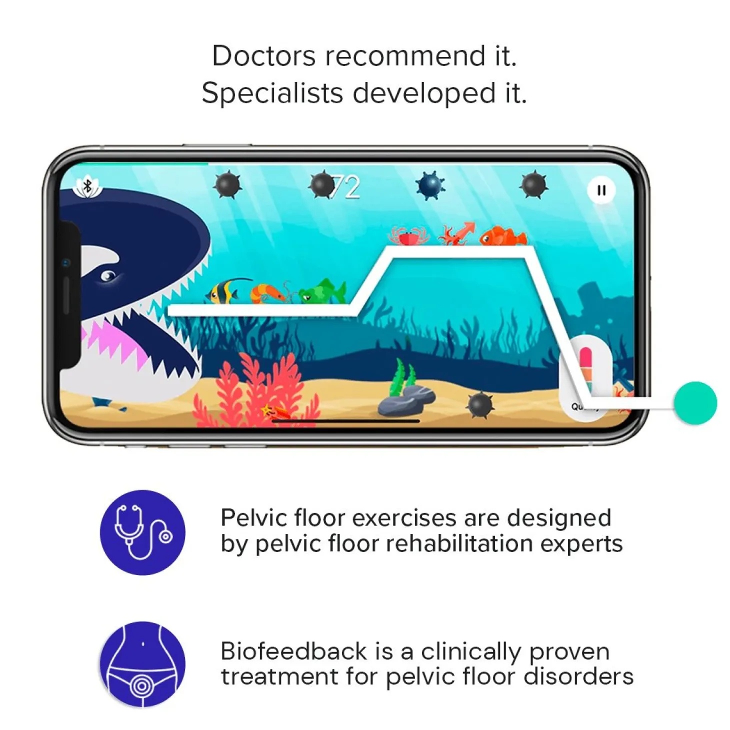Perifit Care+ Dynamische Kegel-oefenapparaat - Lila