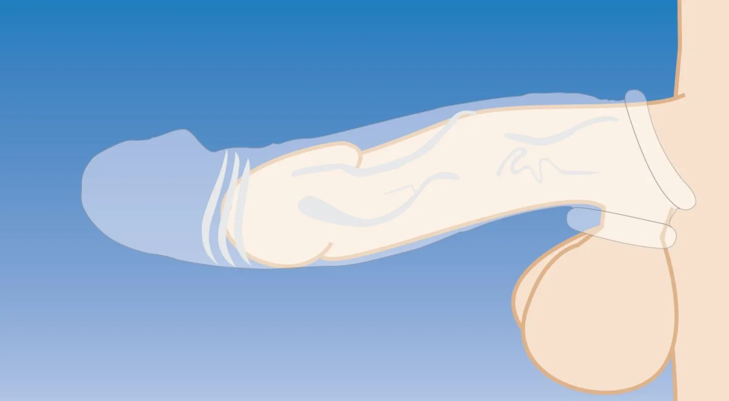 Size Matters - Clear Extender Gebogen Penissleeve